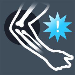 Tennis elbow