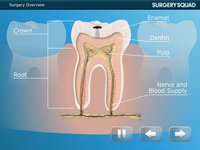 Surgery Squad's Virtual Root Canal Procedure screenshot, image №956007 - RAWG
