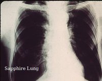 Sapphire Lung screenshot, image №1955934 - RAWG