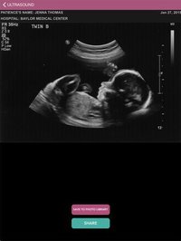 Ultrasound Spoof 2016: Pregnancy Test screenshot, image №1757075 - RAWG