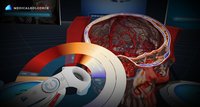 Medical Virtual Reality | Medical VR | DICOM Viewer | Human Body VR | Human Anatomy | Virtual Surgery | Virtual Radiology | MEDICALHOLODECK PRO screenshot, image №1953808 - RAWG