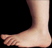 Epic Tickly Feet screenshot, image №3760505 - RAWG