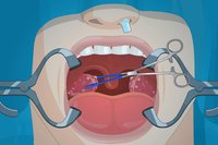 Operate Now: Tonsil Surgery screenshot, image №1976192 - RAWG