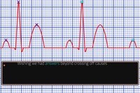 Digital storytelling and the ECG: a case of generalized fatigue and difficult conversations screenshot, image №3869964 - RAWG