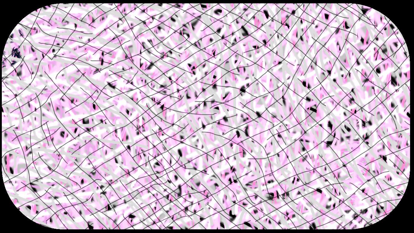 Juxtaposed Crazy Lines