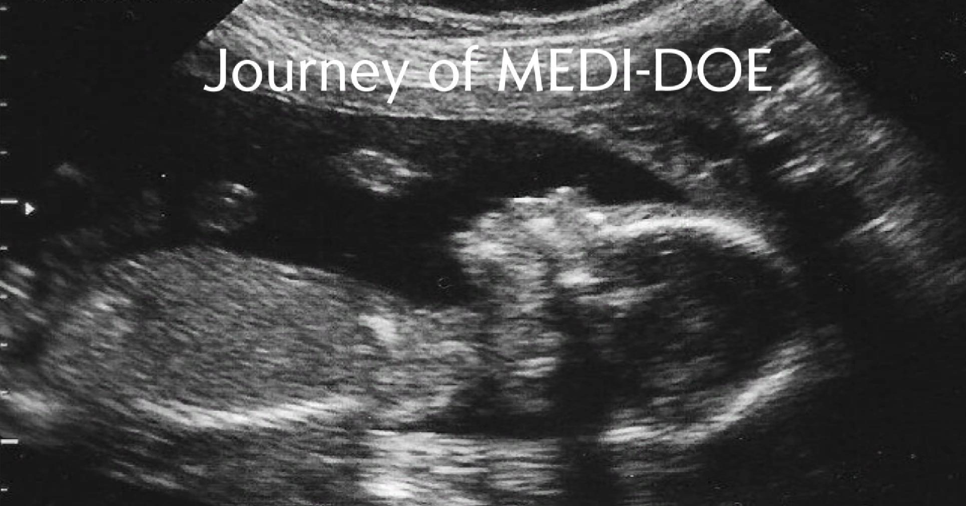 Journey of MEDI-DOE